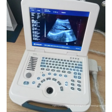 Escáner de ultrasonido mini portátil de bajo precio